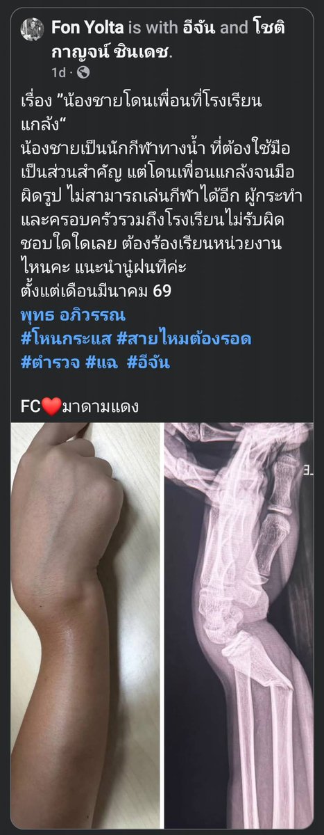 LadyMadMoon's tweet photo. แล้วเด็กเหี้ยที่รุมแกล้งเพื่อน นี่เหี้ยเพราะอะไรคะ เหี้ยเพราะเกม เพราะหนัง เพราะสันดาน หรือเหี้ยเพราะการเลี้ยงดู ตอนเด็กคนนึงโดนทำร้ายไม่มีใครเข้าช่วยเหลือ แต่พอเด็กปกป้องตัวเอง หรือรับมือกับปัญหาแบบผิดๆ แก้ปัญหาด้วยความรุนแรง เสือกมาโทษเด็กว่าเก็บกด ติดเกม

#กราดยิง #ข่าวด่วน https://t.co/avA3kBFq5G