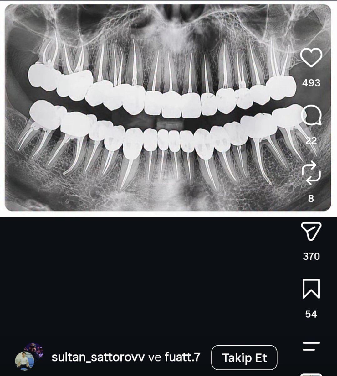 hnyynr's tweet photo. iş bittikten sonra kliniği kapatıp bu yurtdışı tatili yapmıştır aq https://t.co/qqiM4XwurM