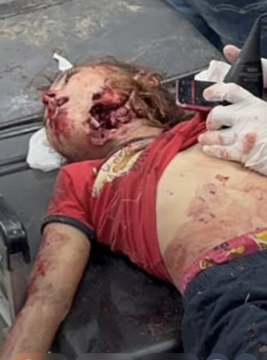 koyundelisi34's tweet photo. Gazze'deki en büyük ZULÜM İslam aleminin sessizliğidir SESSİZ kalmayın

Netanyahu'dan değil Allahtan korkmak lazım 

#NeverIgnoreGaza
 (Gazze'yi Görmezden Gelme) https://t.co/2IDCGP4Q14