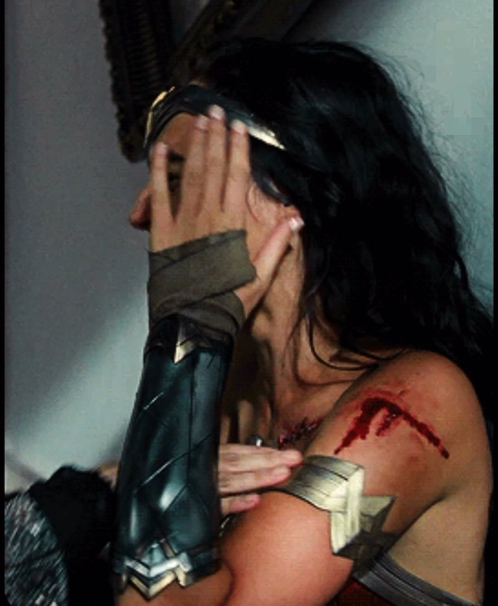 Dimson001789's tweet photo. Gal Gadot getting a nasty scratch on her face while filming Wonder Woman, but is it what the acting? https://t.co/iy1aCHPpJ1