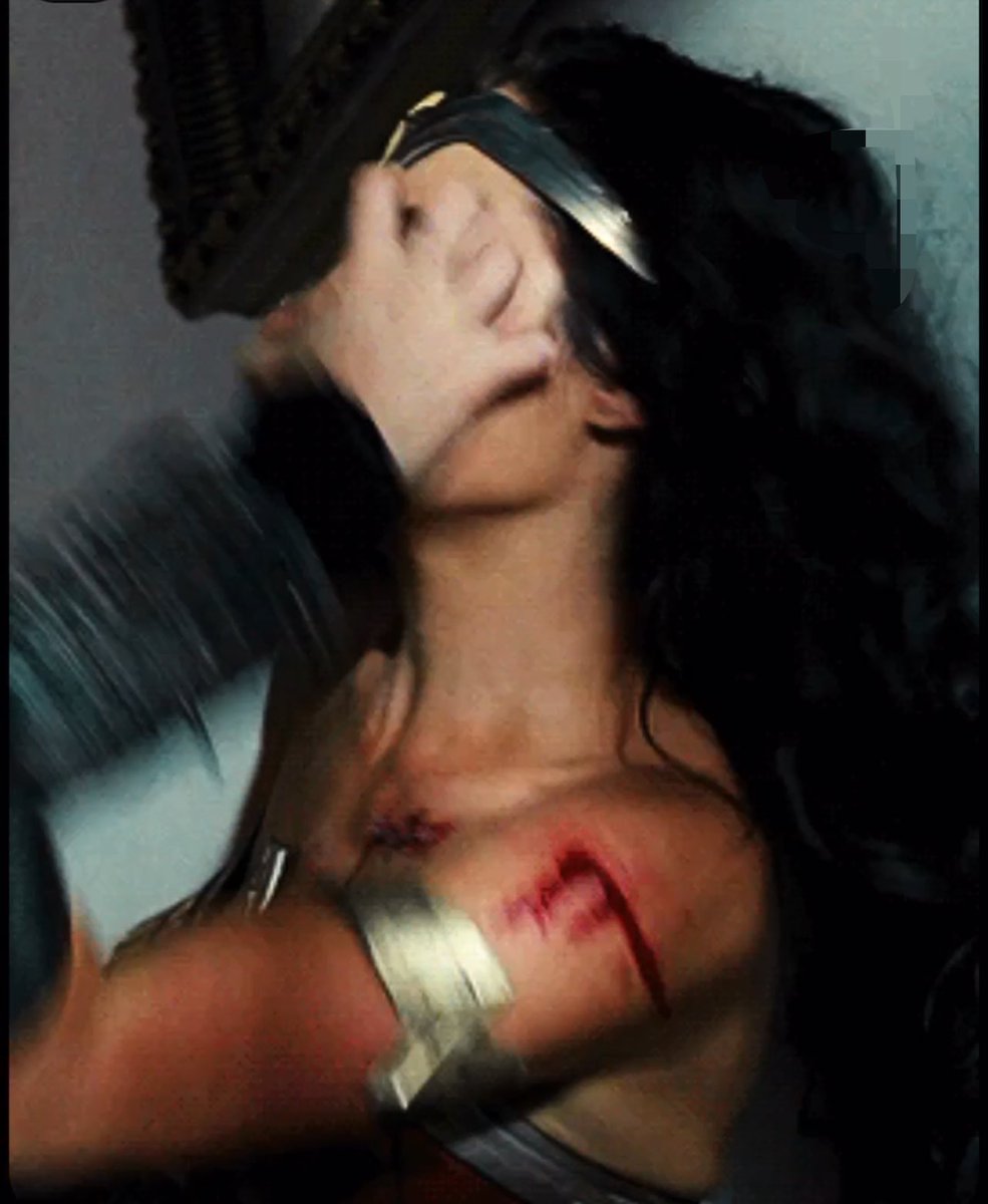 Dimson001789's tweet photo. Gal Gadot getting a nasty scratch on her face while filming Wonder Woman, but is it what the acting? https://t.co/iy1aCHPpJ1