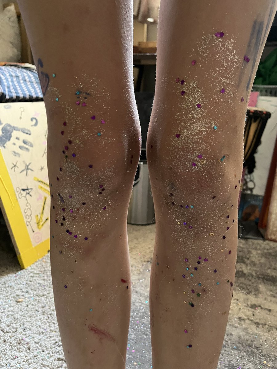 calliedabomb's tweet photo. ayyy i finally got a better blade for my sfx art!!
this is makeup practice for a film!!!
#shedtwt #shtwt #slittwt #cutspo #sfx https://t.co/5ryubFJhyd