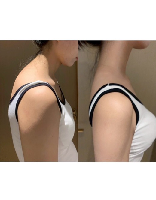 yasechan_diet's tweet photo. 巻き肩、猫背改善民ーーー‼️
今すぐこれやれ！！！姿勢良くなるからまじで痩せて見えるぞ⬇️ https://t.co/rlVMfG5duK