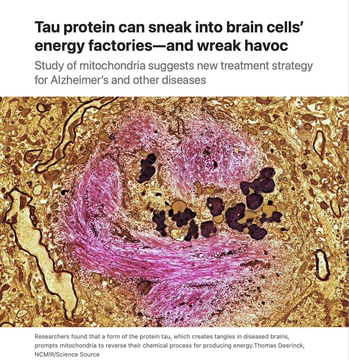 EricTopol's tweet photo. Discovery of a new (bad) impact of tau protein: crippling mitochondria in the brain
https://t.co/VSNX5EF2gN
@NeuroCellPress 
https://t.co/Dbki1uiquO @ScienceMagazine https://t.co/5zEJhxwnqa