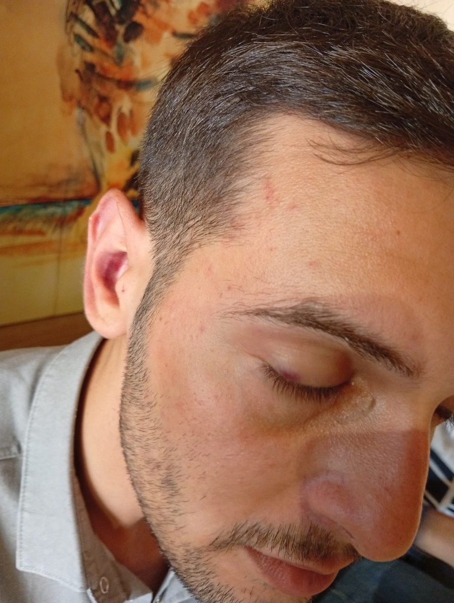 3tayadliaileler's tweet photo. 5 Ağustos günü saat 15.00’da Ankara’da istihbarat birimleri tarafından kaçırılan evladımız Kenan Örpek 1 saat boyunca yoğun işkenceye maruz kalarak işbirlikçilik dayatılmıştır! 
Evlatlarımızın üzerinden o kanlı ellerinizi çekin!
İşbirlikçilik dayatmak şerefsizliktir! https://t.co/mW1q5pxhGW