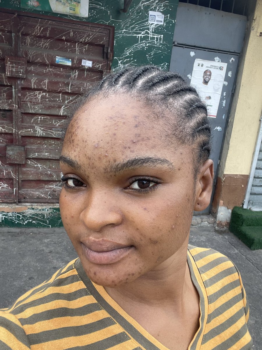 Brattyenori13's tweet photo. God really ate when he created my face🥹🥰 https://t.co/BB3UPnkz24