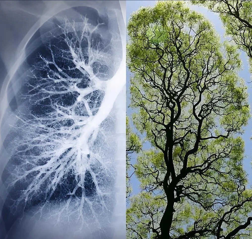 gumseewadaa's tweet photo. It is Allah who creates the lung, 
and who shapes the tree 🤍 https://t.co/wJzgvW7lf7