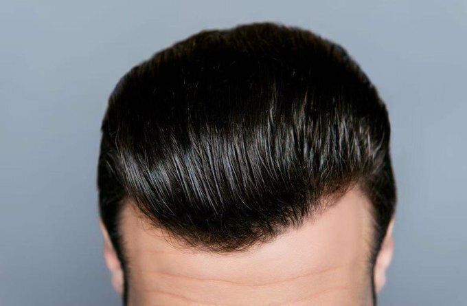 MindsetGOx's tweet photo. Antes de los 50 años, la mitad de los hombres se quedará calvo.

Y lo que comes todos los días está acelerando tu calvicie.

¿Quieres conservar el cabello? Empieza por aquí:

1. Huevos https://t.co/xJ9kdLQMCb