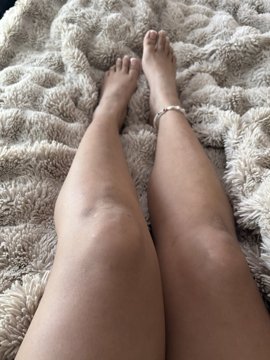 LavenderSheep05's tweet photo. Would you hold them or worship them? 👀👣 #feetfetısh #feetworshi̇p https://t.co/LQlne5hR6X