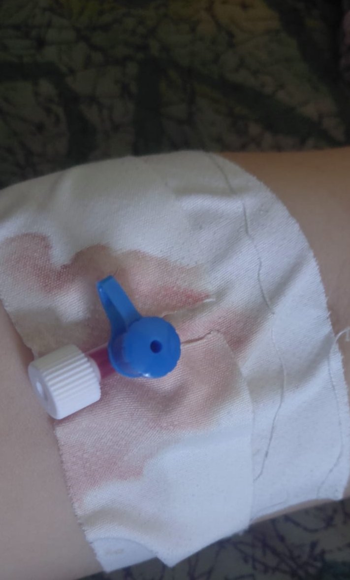 halamoh282's tweet photo. I am a mother who is forced every day to cook over firewood and open fire due to the scarcity of cooking gas and its high prices.

My health has deteriorated as a result of the smoke and heat, and I now rely on IV fluids and medications that I cannot afford https://t.co/TSjeCbQMdO