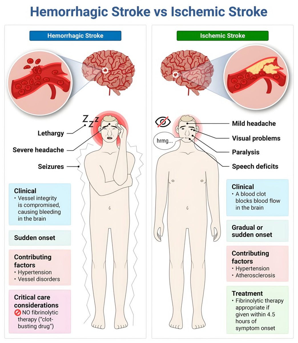 nervemed's tweet photo. Haemorrhagic vs Ischemic Stroke https://t.co/kUTtnKc6aR