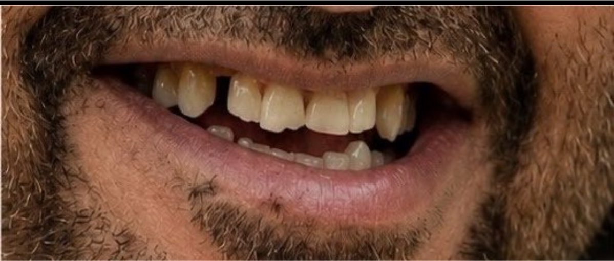 Saba2007_'s tweet photo. حاول شرشبيل يسوي تحالف هندي اسرائيلي يوناني وفشل انصحه يسوي تحالف مع أطباء الأسنان هههههههههههههههههههههههههههههههههههههههههههههههههههه https://t.co/Rb6olSnGAv