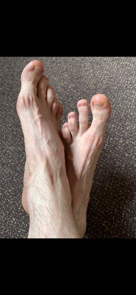 footishcare's tweet photo. Amazing Feet View🥵
#Feet #Toes #Soles #Footfetish https://t.co/wWowX2i56d