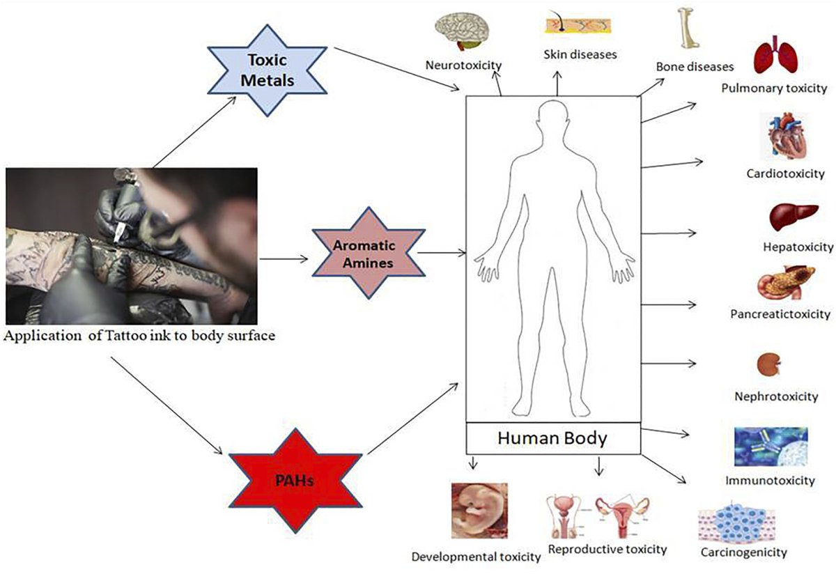 BrandonLuuMD's tweet photo. People with tattos have a 21% higher risk of malignant lymphoma.

Laser removal was linked to an almost 200% increased risk (possibly from the breakdown of toxic compounds). https://t.co/DIkuI1UWOM