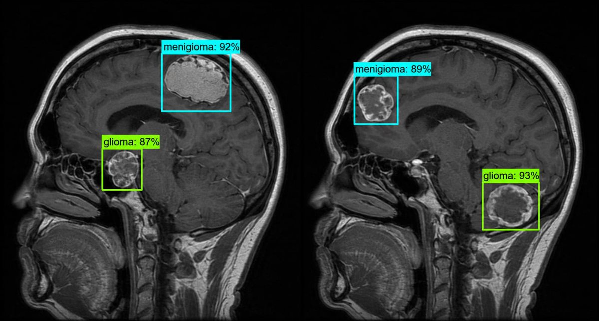 scanwithagera's tweet photo. AI doesn't replace doctors, it empowers them.

Agera is designed to assist medical professionals by highlighting potential findings on medical images, helping improve efficiency and supporting faster clinical decisions.

Final diagnosis always remains in the hands of qualified healthcare professionals.