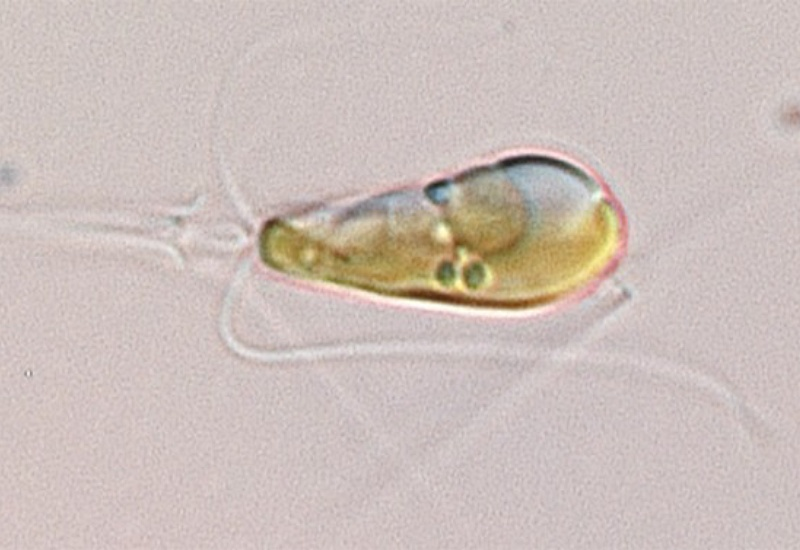 forallcurious's tweet photo. The Once-in-a-Eon event that gave Earth plants has been confirmed to happen again

a very rare evolutionary event in which a marine bacterium and an algal host have merged in a way that the bacterium effectively becomes an organelle inside the algal cell capable of fixing nitrogen — something no other known eukaryote has been confirmed to do.

This process, called endosymbiosis, has only happened a handful of times in Earth’s history, and past occurrences led to mitochondria and chloroplasts, which underpin complex life and plant evolution.