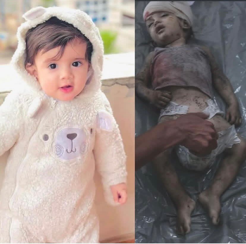 sub_allah's tweet photo. Shame on us

Before &amp; After   🇵🇸💔 https://t.co/pIcSKBjx7w
