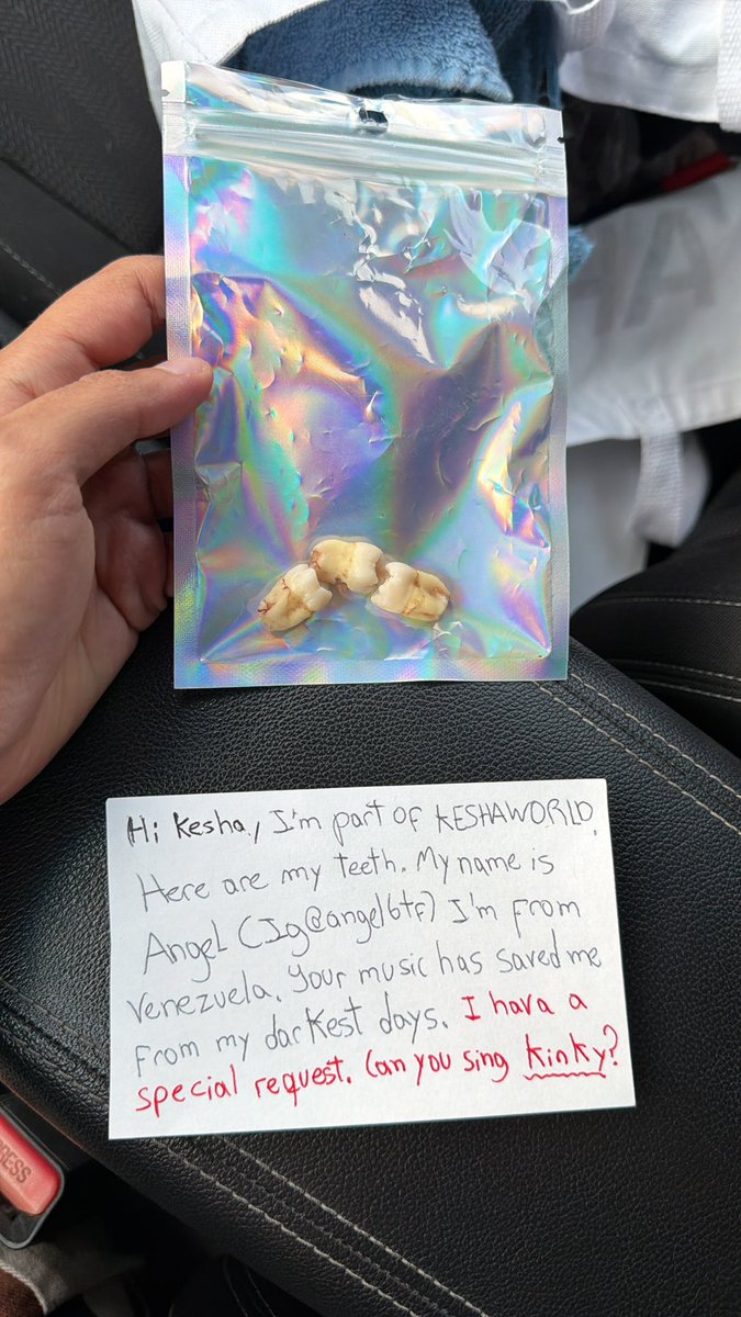 angelbtf1's tweet photo. Teeth ready for Kesha’s concert tonight @KeshaRose @KeshaToday @RecordsKesha #freedomtour #kesha https://t.co/H1E09r6M2h
