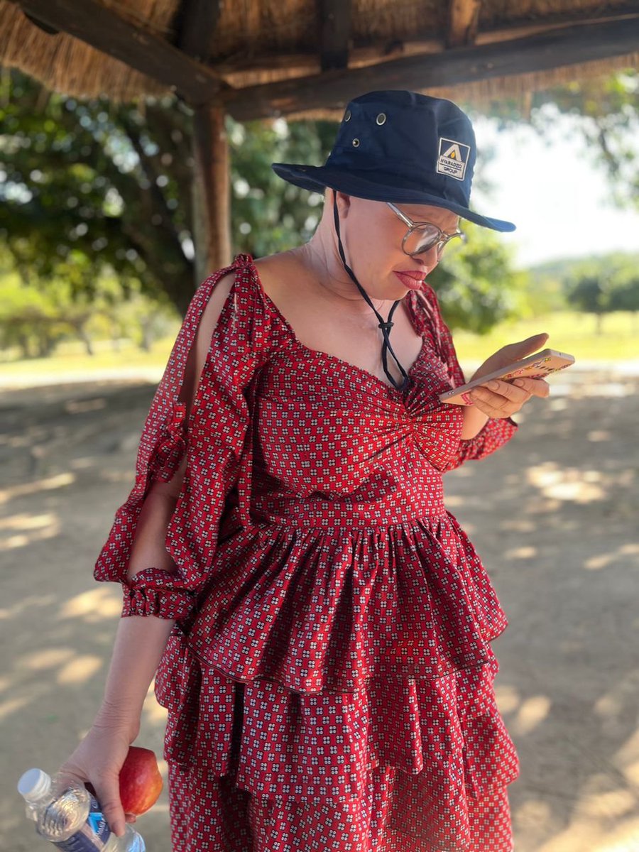 The_Tonga_Queen's tweet photo. Ok lm here as me any question about albinism, 
Open Discussion 📍 https://t.co/gGCVRuured