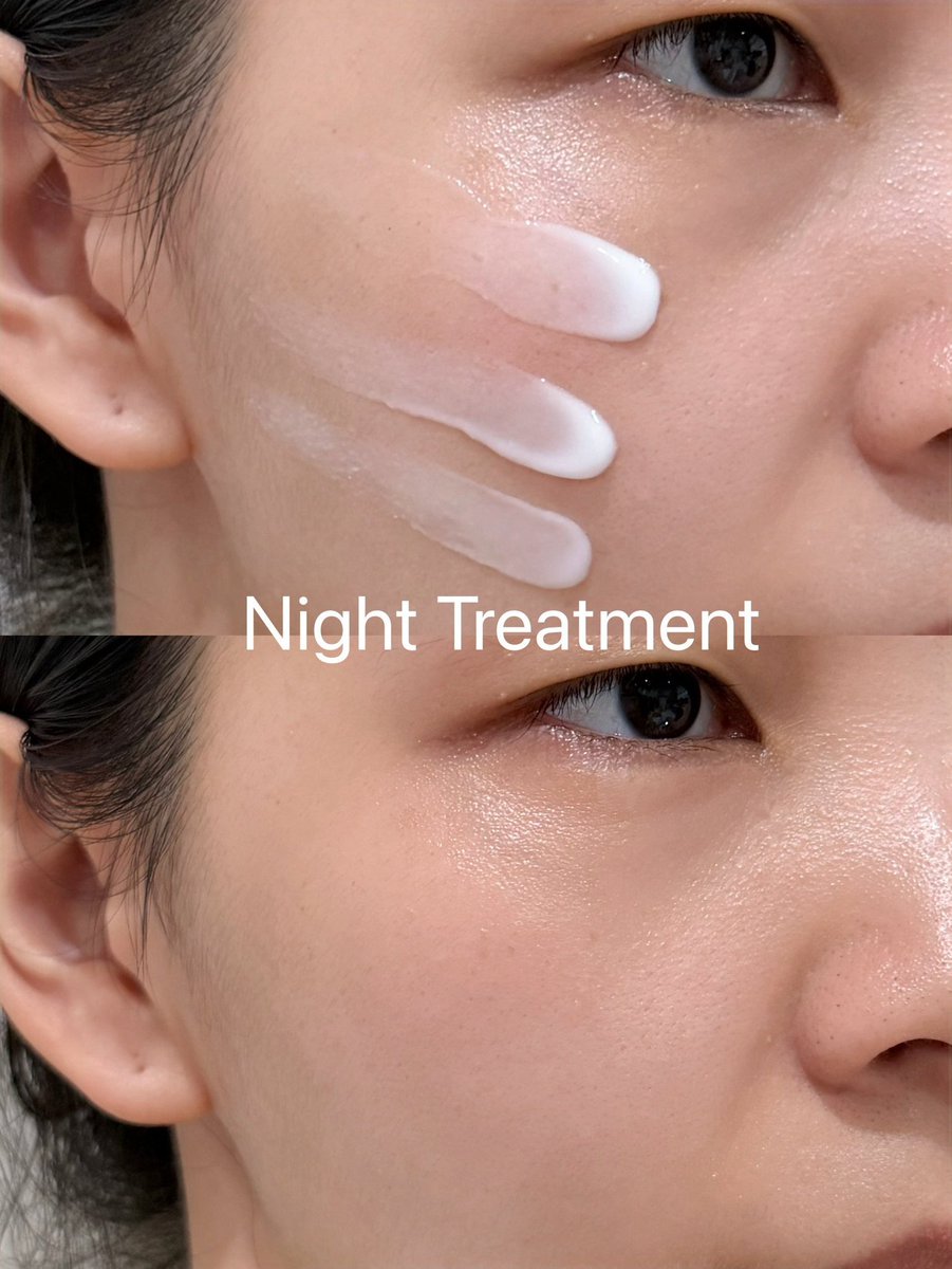 callmevns's tweet photo. จบปัญหาหน้าหมองโทรมบี้ เพราะใช้ KA Bright &amp; Glow Spotless แพคคู่ เช้าใช้ Day Cream ลดจุดด่างดำ ปรับผิวใสสม่ำเสมอ ก่อนนอนทา Night Treatment เน้นเติมน้ำ ล็อคความชุ่มชื่น ตื่นเช้ามาหน้าพร้อมรับเมพอัพ เนื้อเกลี่ยง่าย ซึมไว ต้องเปิดใจลอง ราคาดีมั่กกก https://t.co/5W9GzDCy3o