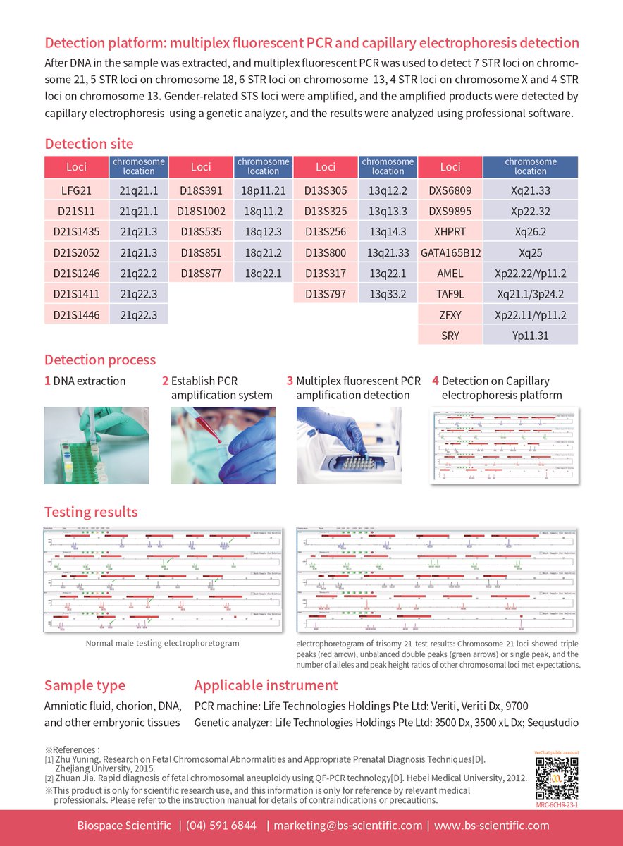 biospace_01's tweet photo. 𝗠𝗶𝗰𝗿𝗼𝗿𝗲𝗮𝗱𝗲𝗿𝗧𝗠 𝗖𝗵𝗿𝗼𝗺𝗼𝘀𝗼𝗺𝗲 𝗮𝗻𝗲𝘂𝗽𝗹𝗼𝗶𝗱𝘆 (𝗧𝟮𝟭/𝗧𝟭𝟴/𝗧𝟭𝟯/𝗫/𝗬) 𝗱𝗲𝘁𝗲𝗰𝘁𝗶𝗼𝗻 𝗸𝗶𝘁. Abnormal chromosome number is one of the important causes of birth defects. 
.
.
Visit: https://t.co/Y64AC2uv2o
#Microreader #ChromosomeAneuploidy https://t.co/j2kJLilN1j