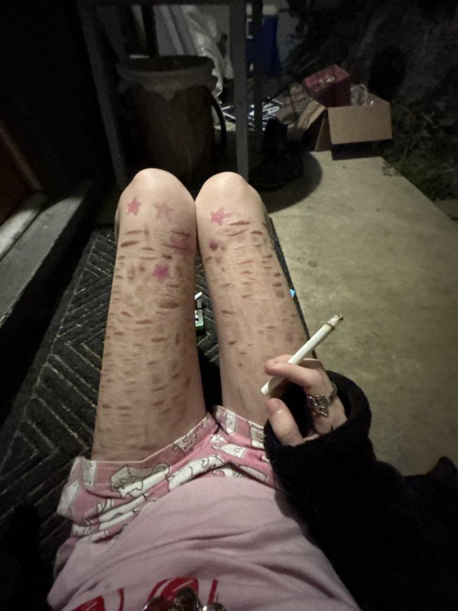 allgrayedout's tweet photo. bodycheck and scar check

fake body sfx https://t.co/t6ffzHJBOE