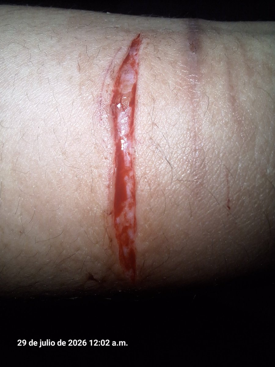 plskillyuorself's tweet photo. realistic depiction of injury for medical purposes. ALL FAKE, IT'S MAKEUP https://t.co/R7hieRix0s
