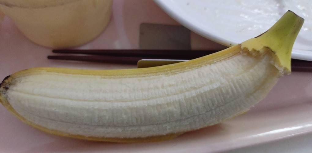 umeruko's tweet photo. 左:入院初日の剥き🍌
右:退院日の剥き🍌

君は片手でバナナの皮を剝けるか https://t.co/FnlWV2domc