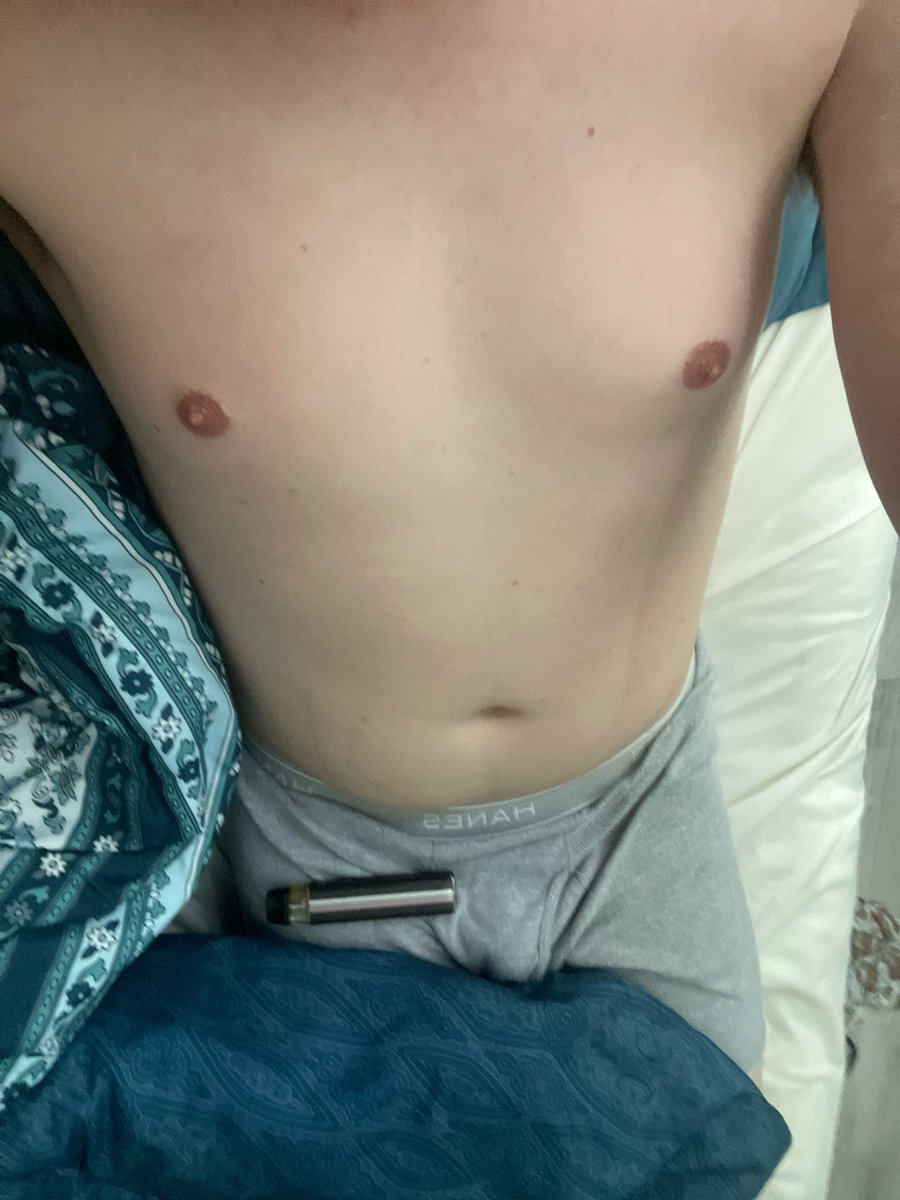 lodlinx's tweet photo. My tummy looks like a geriatric alien https://t.co/tzfj5gTunO
