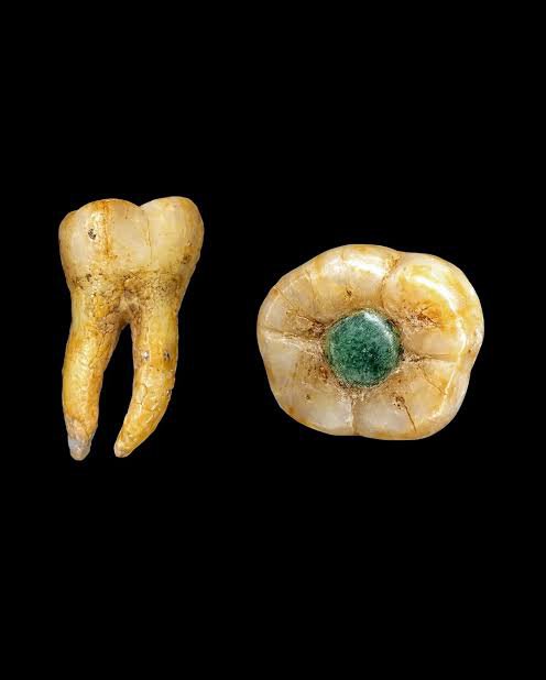 archeohistories's tweet photo. More than a thousand years ago, Maya dental specialists were creating decorative tooth inlays with a level of precision that still impresses researchers today.

They carefully drilled small cavities into living teeth and fitted pieces of jade, turquoise, pyrite, and other minerals into the openings.

The work was not simply a rough attempt to push stones into enamel.

The holes were shaped with care, and the inlays were secured using durable cements made from mixtures that included plant resins, mineral materials, and other organic compounds.

Modern chemical analysis has found ingredients with antibacterial, antifungal, or anti-inflammatory properties in some of these ancient adhesives.

That may have helped protect the tooth and surrounding tissue while keeping the decoration in place.

The strongest evidence of their skill is that some inlays have remained attached for centuries.

Researchers believe the practice was usually decorative or connected to identity and status rather than a treatment for damaged teeth. It also appears across different levels of Maya society, suggesting that dental modification was not reserved only for rulers.

Imagine the knowledge required.

The specialist needed to drill without breaking the tooth or reaching the sensitive pulp. The stone had to fit the cavity. The adhesive had to hold in a wet mouth exposed to pressure, food, and bacteria every day.

This was accomplished without electric tools, modern anesthetics, or synthetic dental cement.

Ancient dentistry is often described as primitive because it lacked modern equipment.

The Maya evidence tells a more complicated story. Their methods combined craftsmanship, botanical knowledge, mineral science, and an understanding of the human tooth.

What looked like jewelry was also an extraordinary technical achievement, small enough to fit inside a smile and strong enough to survive for a millennium.

#archaeohistories