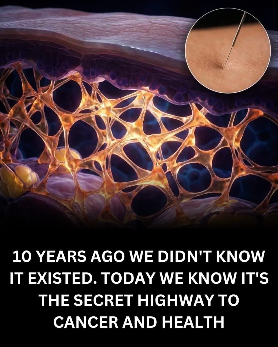 scitechgirl's tweet photo. 🚨 THE “HIDDEN NETWORK” INSIDE YOUR BODY SCIENTISTS MISSED FOR DECADES

For over a century, anatomy books showed our body as solid layers: skin, fat, muscle. That was… until 2018. Using new live-tissue imaging, scientists discovered the interstitium, a vast network of tiny fluid-filled spaces beneath the skin and around organs. Old microscope slides had flattened them, hiding their true structure.

This network may act like a shock absorber and help fluids move through the body. Researchers are also studying its role in how cancer spreads.The discovery, led by Neil Theise and published in Scientific Reports, reminds us: sometimes the most amazing discoveries are what’s been there all along, just unseen.