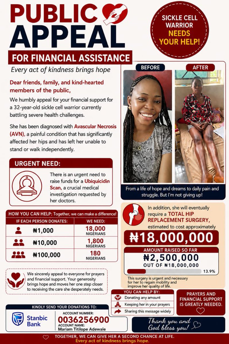 OreoluwaAdewal5's tweet photo. Dear all,
I hope we are all well?

It is with a heavy heart I am writing and appealing to you all concerning my health challenges, I am Mariam Titilope Adewale a  graduate of Tai Solarin University of Education I am a sickle cell warrior battling with end stage Avascular Necrosis, a situation that now makes it impossible for me to stand or walk by myself and kept me in severe pains everyday.

I have been recommended to undergo a bilateral hip replacement surgery that costs 18million naira. Fellow Nigerians 2.5million has been raised out of the 18million Naira so far. I am hereby appealing to you all to kindly donate to save my life. Please No amount is too small please help my life I don’t want to lose my life , I have dreams to achieve. Please you can also help to repost, tag and retweet people with kind heart who can make me walk again.

Please donate and help me repost the flyer to reach a wider audience.
Account No: 0036256900
Acc Name: Mariam Titilope Adewale
Bank: Stanbic Bank 
Phone no: +234813888 9815

Please help me like, repost, quote and tag these handles in the comment session to call their attention 🙏🙏🙏
@Wizarab10 
@the_beardedsina 
@UnkleAyo 
@oku_yungx 
@Morris_Monye