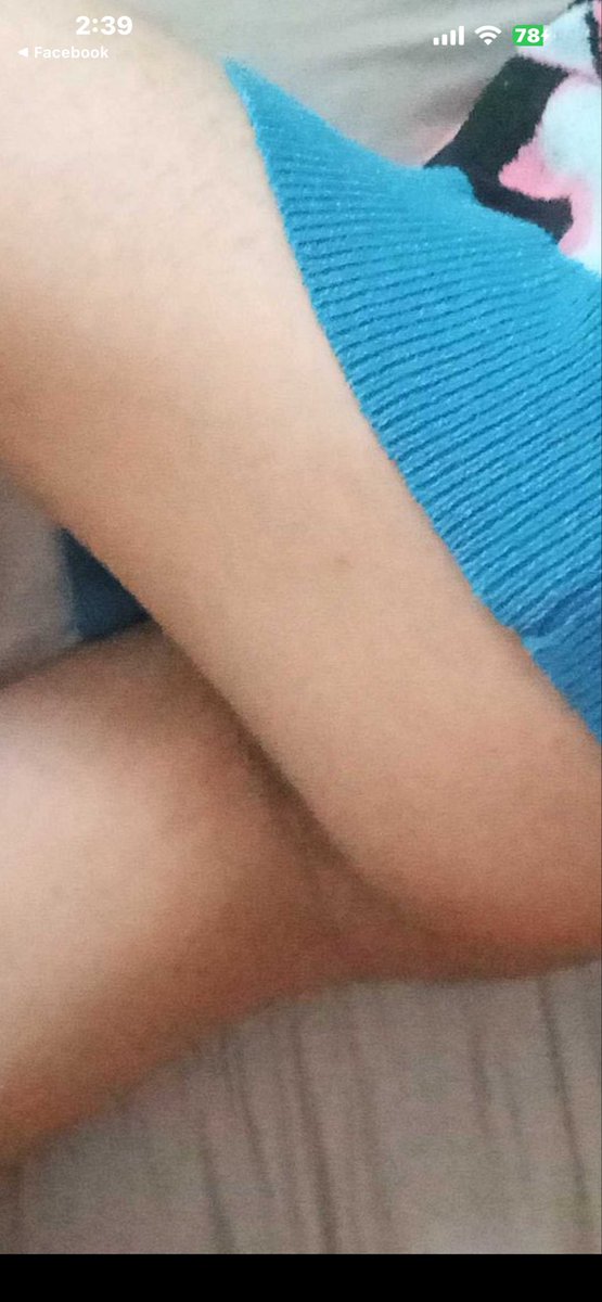 vaughan_grayson's tweet photo. @Arcturuss_AD That cheek/thigh crease is doing something to me. https://t.co/BxUySHH4C2