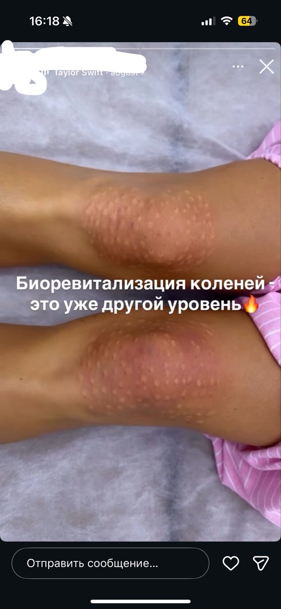 chikipyap's tweet photo. БЛЯЯЯЯЯЯЯЯЯЯЯЯЯТЬ 
ДРУГОЙ УРОВКНЬ ДОЛБОЕБИЗМА Я ПРАВИЛЬНО ПОНИМАЮ? https://t.co/2Kyk4uumS7