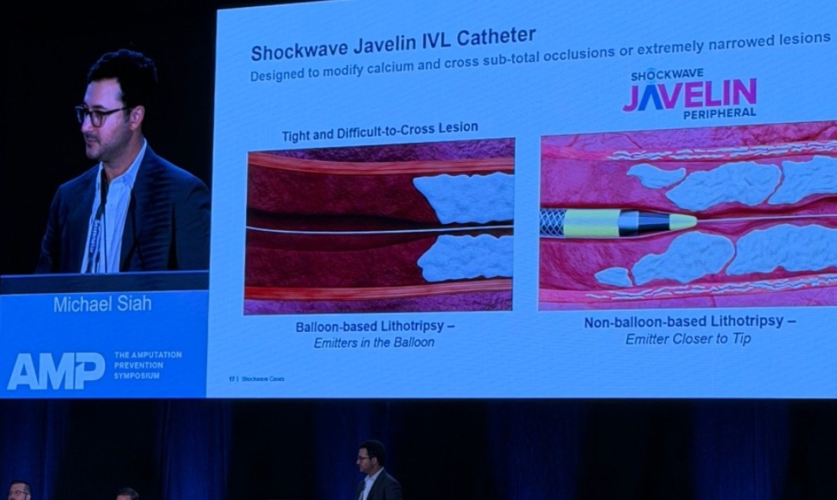 ShockwaveIVL's tweet photo. #AMP2026 is a wrap! Thank you to everyone who joined our #ShockwaveIVL symposium. We hope the case-based insights and expert perspectives spark new possibilities in your approach to patient care. A special thank you to Drs. Micah Watts (@Watts_IR), John Winscott and Michael Siah (@michaelcsiah) for sharing their expertise and helping make this session such a success. We appreciate you!
Presenting physicians are paid consultants of Shockwave Medical.
US Rx only. Safety Info: https://t.co/as4irbY3DX
Product availability may vary by country.