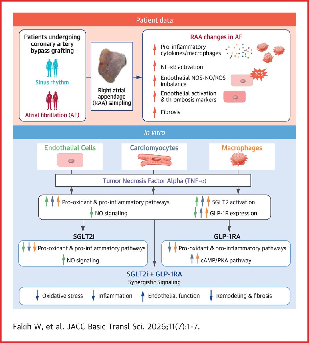 Synergistic Effects of SGLT2 Inhibitors and GLP-1R Agonists on Inflammation-Associated Oxidative Stress in AF RAA inflammation correlates with SGLT2 and GLP-1R expression. SGLT2 and GLP-1R modulation exert synergistic antioxidant effects in RAA