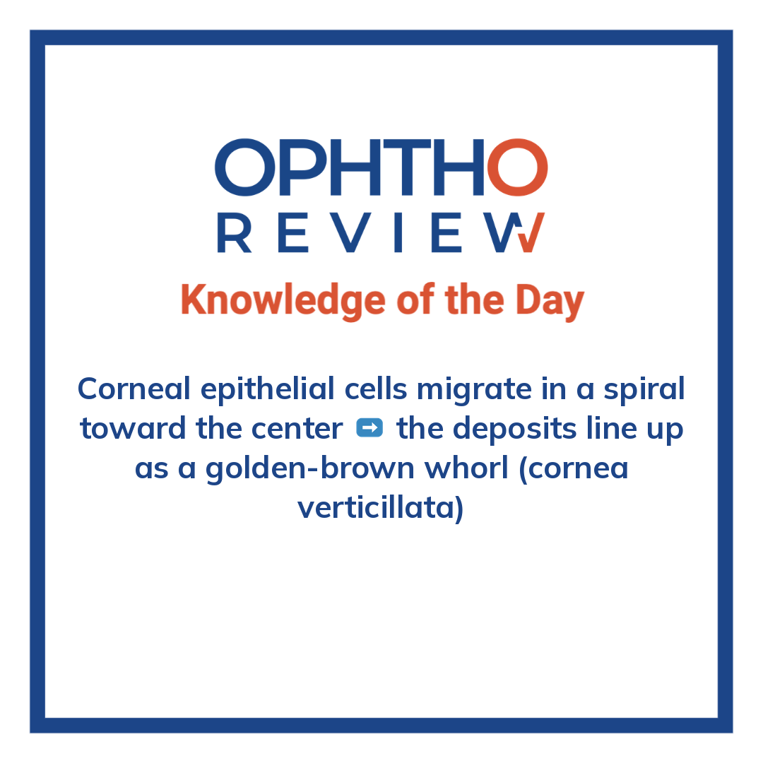 ophthoreview's tweet photo. Whorl-shaped deposits

#ophthoreview #ophthalmology #ophtho #ophthalmologyresidency #ophthalmologist #surgicaleducation #medicaleducation #meded #surgery #medicalstudent #medicine #medicalschool #resident #residency https://t.co/DZ9L23bprG