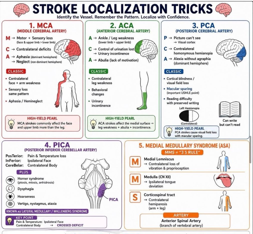 VitalViz's tweet photo. 🧠 Stroke Localization Tricks . https://t.co/C0TJ376tDp
