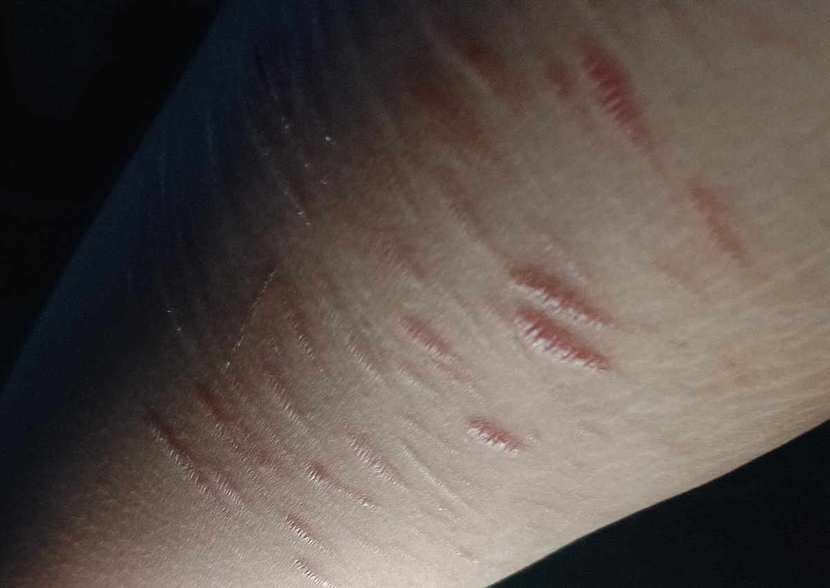 Dork_isScared's tweet photo. I hope they never fade.
.
.
All AI generated fake sfx for Halloween 
.
.
#scarspo #slittwt #shtwtt https://t.co/YCG4AMB7Ax