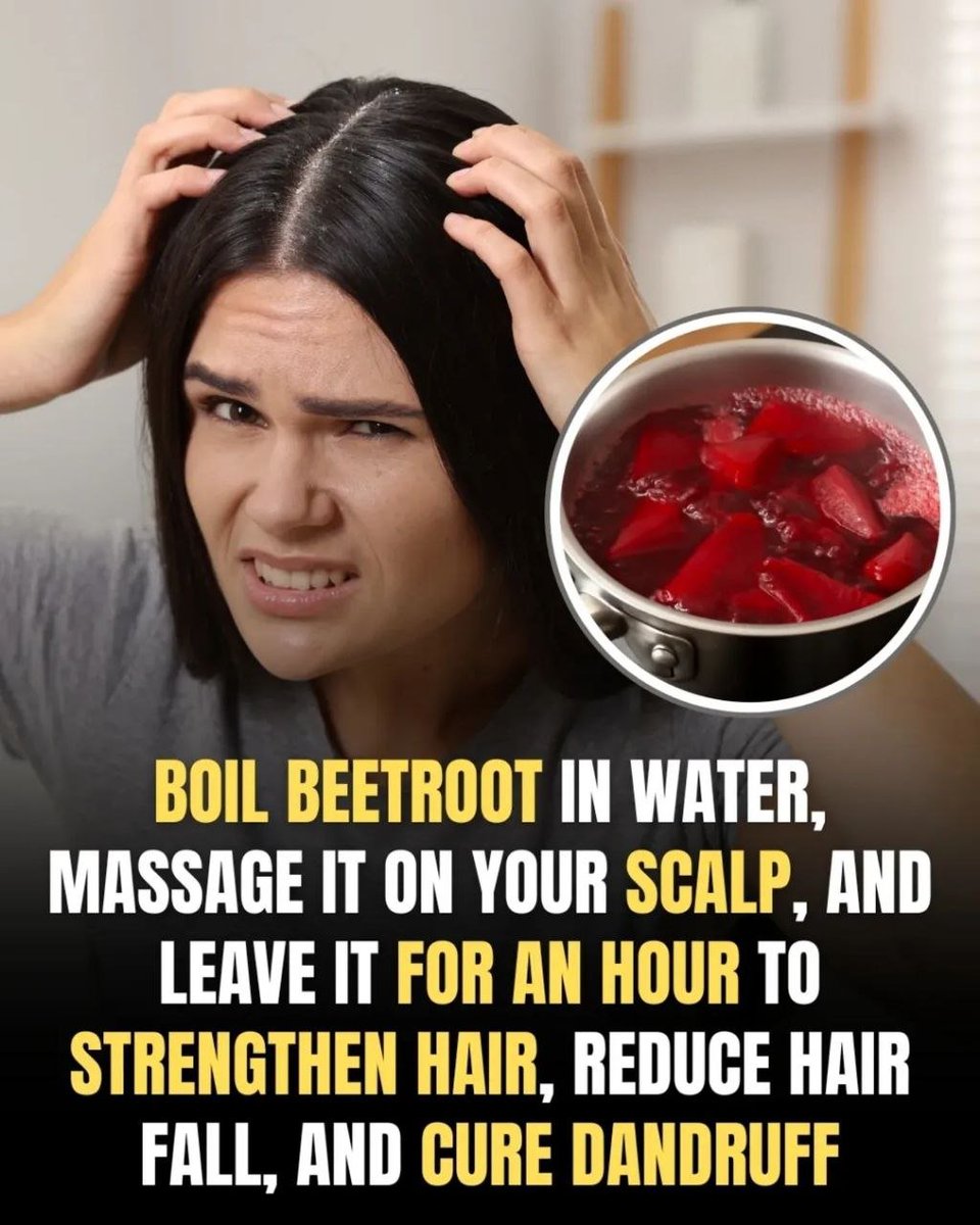 BarbaraOneillAU's tweet photo. ✨ Say goodbye to hair troubles with a simple natural remedy!

Beetroot for Hair Care:

1. Strengthens Hair – Packed with vitamins & minerals that nourish your scalp.

2. Reduces Hair Fall – Improves blood circulation & promotes healthy roots.

3. Cures Dandruff – Natural antifungal & detoxifying properties keep flakes away.

4. Adds Shine – Leaves your hair soft, smooth & naturally glossy.

How to Use: Boil beetroot in water, massage the extract onto your scalp, and leave it on for an hour before rinsing.

A natural solution for stronger, healthier, and dandruff-free hair!