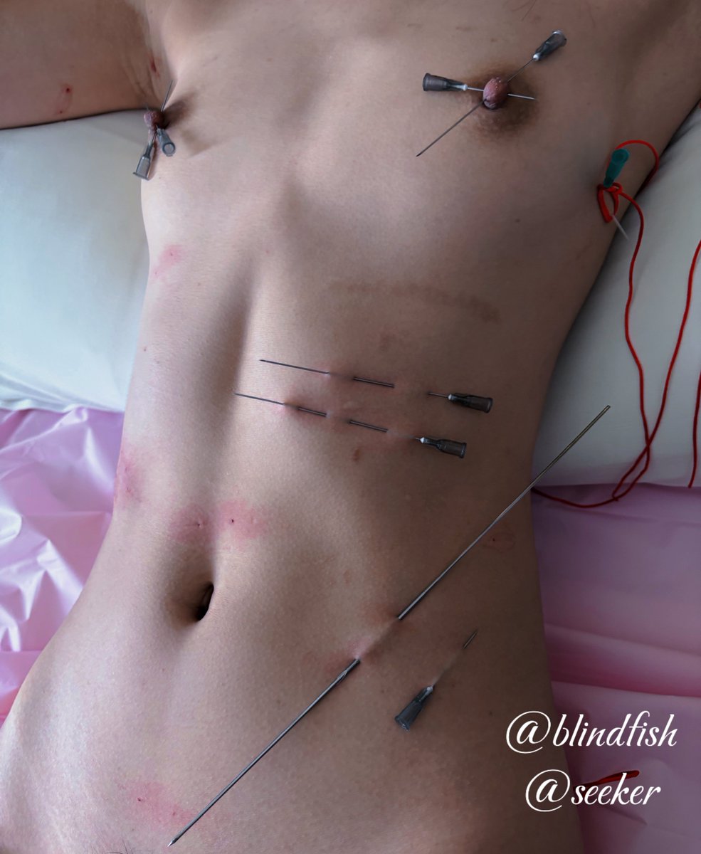 blindfish_blue's tweet photo. 贯穿痛

🪡： @SethBorrison7 
👁️： @blindfish_blue 

#穿刺 #bdsm #sm https://t.co/mfeERsZSqI