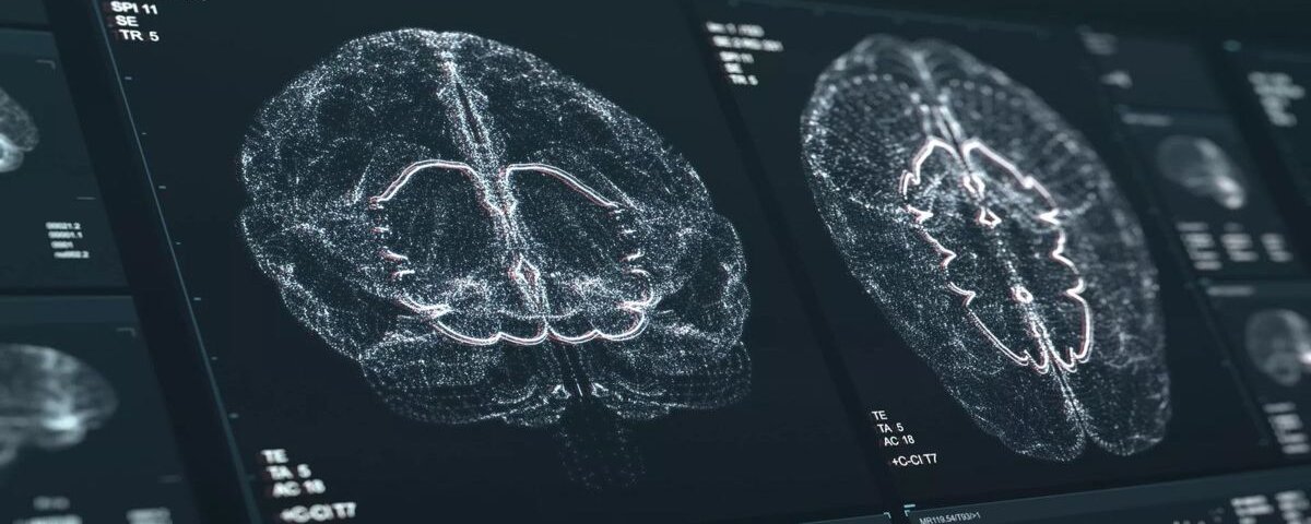 Neuroplasticity: Rewire Your Brain Through Repetition