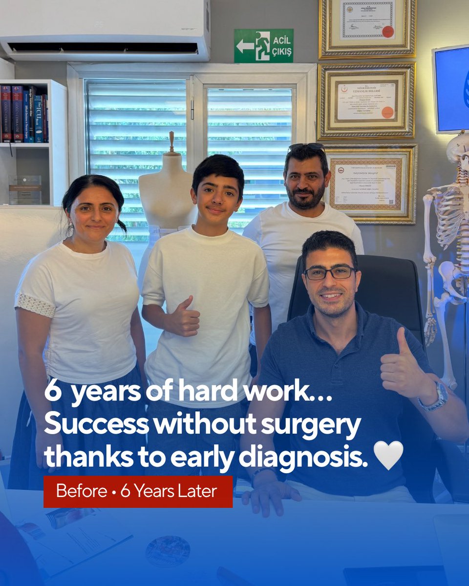 drpektus's tweet photo. 🩺🤍 Sometimes, the most successful treatment is the one that starts at the right time.

Our journey with this patient began in 2020, when he was only 7 years old.

#pectusexcavatum #vacuumbell #pectustreatment #chestwalldeformity #drpectus https://t.co/C2gc5HLJo6