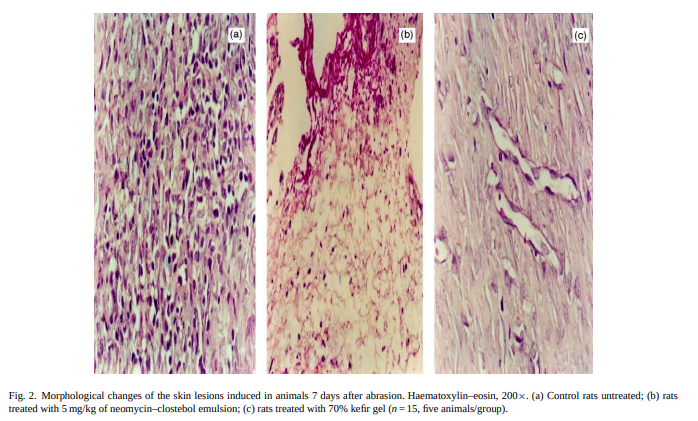 toronjilpapi's tweet photo. El kéfir no es un simple lácteo fermentado, sino una matriz simbiótica viva capaz de modular la microbiota y transformar la salud metabólica e inmunológica.

Consumir kéfir de forma regular es una de las estrategias biológicas más accesibles y potentes para restaurar la barrera intestinal y combatir la inflamación sistémica.

Revisiones científicas confirman que la compleja simbiosis de bacterias y levaduras en el kéfir produce compuestos bioactivos únicos que van más allá de la nutrición básica, respaldando su uso terapéutico y preventivo.

Principales hallazgos:
- El kéfir estándar debe contener un mínimo de 10^7 UFC/ml de microorganismos totales y no menos de 10^4 UFC/ml de levaduras activas para garantizar su potencial probiótico.
- Contiene kéfiran, un exopolisacárido exclusivo (producido principalmente por *Lactobacillus kefiranofaciens* y *Lactobacillus kefiri*) con estructura de D-glucosa y D-galactosa (relaci��n 1:1), resistente a la hidrólisis enzimática del sistema digestivo.
- Los granos de kéfir están compuestos estructuralmente por un 45.7 % de mucopolisacáridos, 34.3 % de proteína total, 4.4 % de grasa, además de ser ricos en vitaminas del complejo B, vitamina K, calcio, fósforo y magnesio.
- Las bacterias aisladas del kéfir demuestran una alta resistencia al pH ácido del estómago y a las sales biliares del tracto gastrointestinal, adhiriéndose con éxito a la mucosa intestinal.
- Su consumo regular mejora la digestión y la tolerancia a la lactosa, actúa sobre el colesterol plasmático, regula la glucosa y ejerce efectos antihipertensivos mediante la inhibición de la enzima convertidora de angiotensina (ECA).

* ¿Qué hace que el kéfir sea superior a otros lácteos fermentados?

A diferencia del yogur convencional, el kéfir se produce a partir de granos que albergan una asociación simbiótica compleja de bacterias ácido-lácticas, bacterias ácido-acéticas y levaduras (tanto fermentadoras como no fermentadoras de lactosa). Esta diversidad microbiana única genera una gran cantidad de metabolitos activos —como péptidos bioactivos, bacteriocinas y ácidos orgánicos— que optimizan la salud digestiva, inmunológica y metabólica de forma integral.