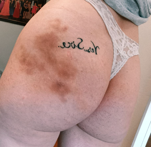 _FrauDana_'s tweet photo. Feliz 8/8 ๐๐ฅ๐
#bdsmู #spank #spankday #ass #bruisedass #bruises https://t.co/WexgLBGS56
