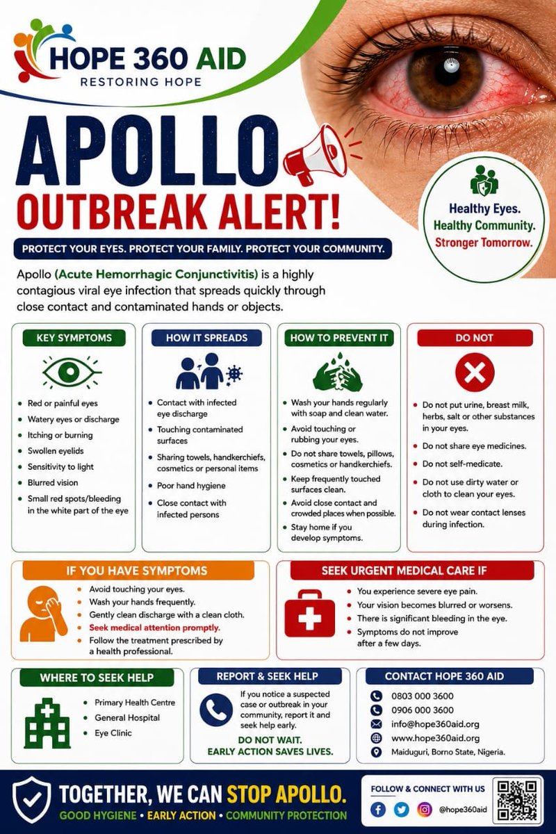 hope360aid's tweet photo. 🚨 Public Health Awareness – Apollo Outbreak 👁️
Due to the recent outbreak, it is important that we all stay informed and take simple preventive measures to avoid further spread.
Please take a moment to go through the flyer and share the information with others. https://t.co/7C2QniIHWW