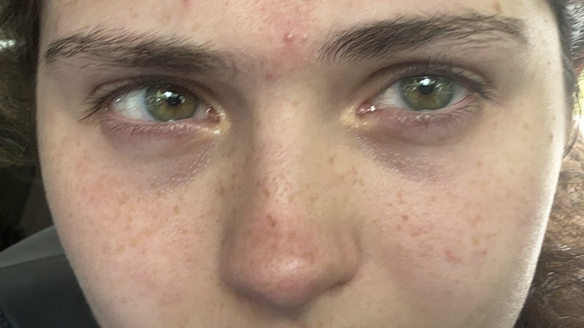 dearborrn's tweet photo. Having bright eyes on a sunny day means tearing up when you go outside https://t.co/5aoH7cyokt