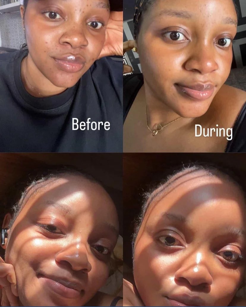 wisrael299's tweet photo. What skincare product can make my face to shine like this?.. Pls you guys can recommend https://t.co/xdnO06StPs