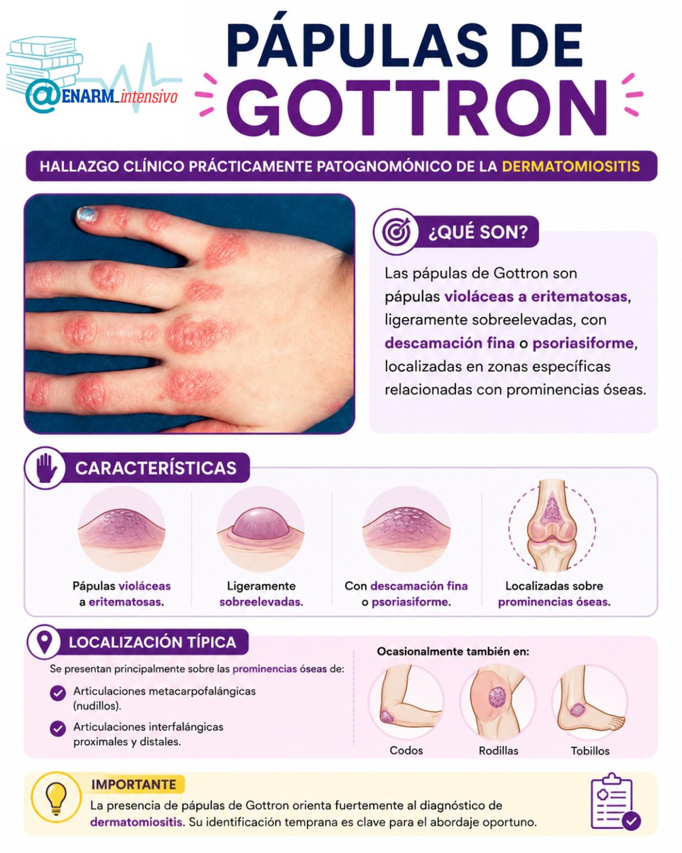 ENARM_intensivo's tweet photo. 💢PÁPULAS  DE  GOTTRON

#ENARM_INTENSIVO #ESTUDIA_MEDICINA https://t.co/ewup4kBuyK