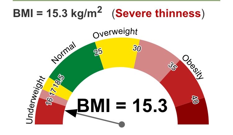 nebulouscoffin's tweet photo. reaching bmi 14 💔 https://t.co/8fOjfli3gp